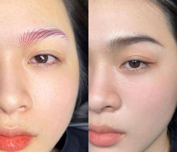 Khách Hàng Thực Tế Tại Thẩm Mỹ Công Minh